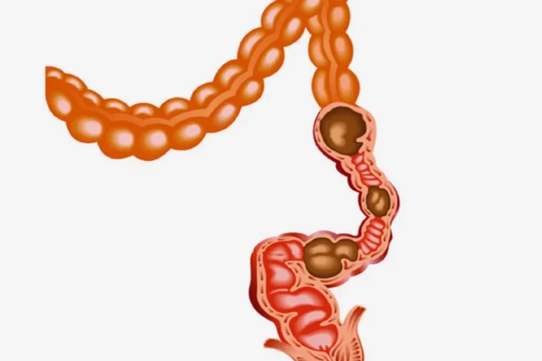 ألياف المعدة